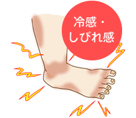 冷感・しびれ感